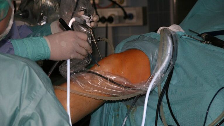 arthrosis surgical treatment