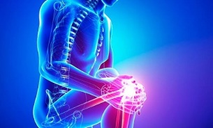 stages of knee joint arthrosis