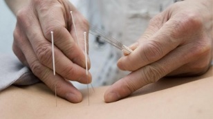 lumbar osteochondrosis acupuncture