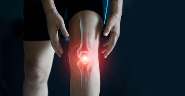 Knee articulation arthrosis