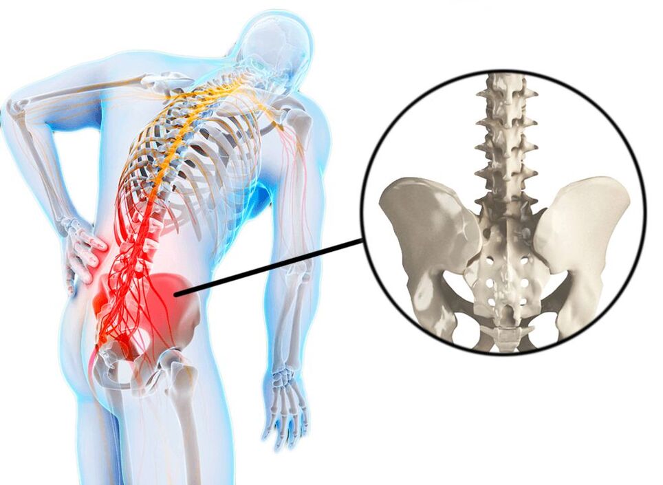 low back pain